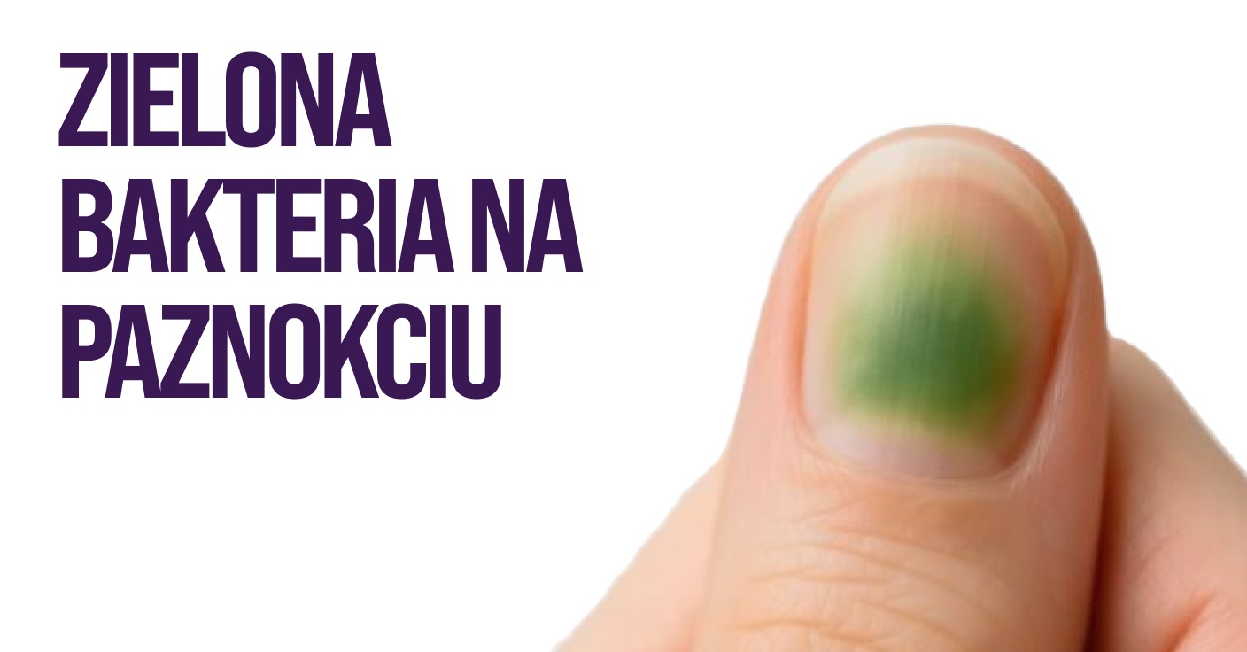 Zielona bakteria na paznokciu od czego powstaje
