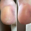 Resultum Anti Crack Cream Jojoba for hands and feet from cracks 25 ml - Фото №5