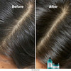Haarmasker L'Oreal Scalp Advanced 250 ml - Фото №3