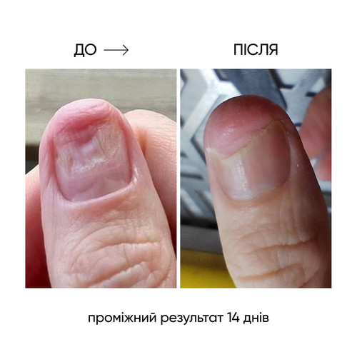 Регенерирующее масло NAILSOFTHEDAY Onistop против онихолизиса 8 мл - Фото №2