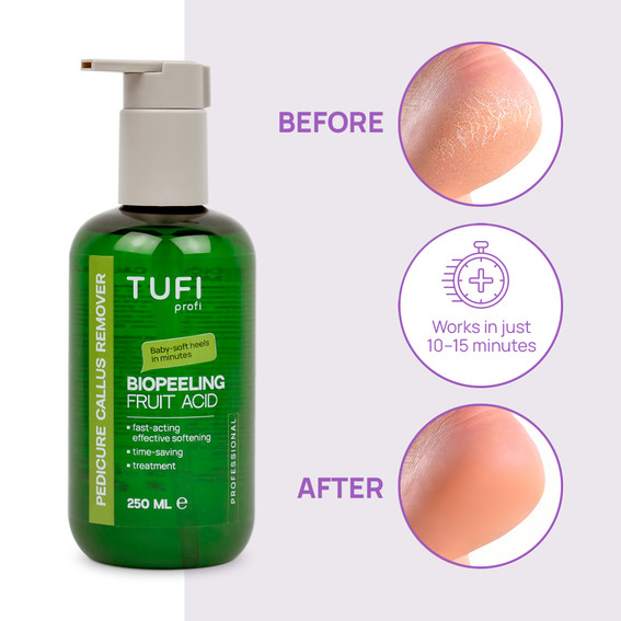 Pedicure remover TUFI profi BioPeeling Fruit Acid voor het verzachten van ruwe huid op de voeten zuur 250 ml (0330979) - Фото №2