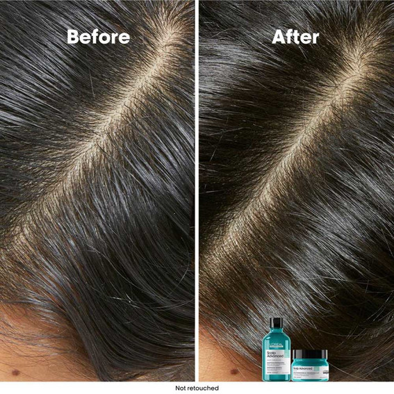 Haarmasker L'Oreal Scalp Advanced 250 ml - Фото №3